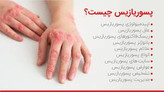 کرم ویتامین E و آلوئه ورا کمک به درمان پسوریازیس ویتابلا