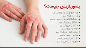 کرم درمان پسوریازیس با کمک کرم ویتامین E و آلوئه ورا ویتابلا اصل ضمانتی مستقیم از شرکت ایرانیان زمین